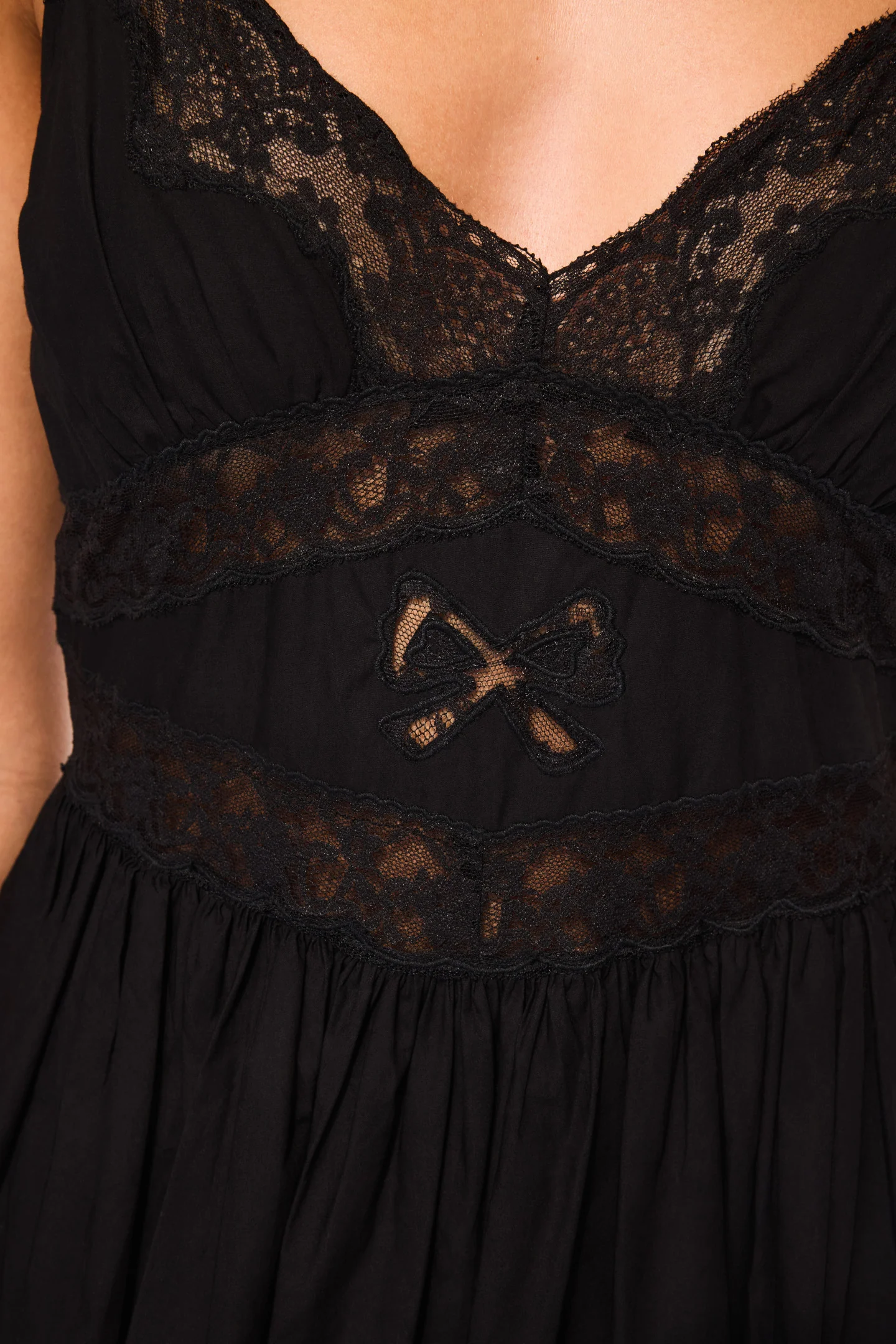 Zima Cotton Lace Bow Mini Dress - Image 3